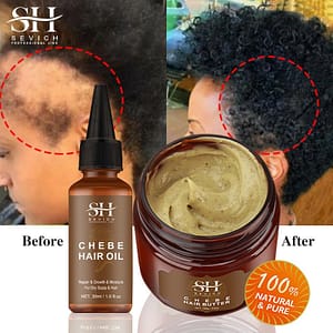 Fast-Hair-Growth-Set-Chebe-Oil-Traction-Alopecia-Hair-Strengthen-Mask-Anti-Break-Loss-New-Africa Fast Hair Growth Set Chebe Oil Traction Alopecia Hair Strengthen Mask Anti Break Loss New Africa Baldness Treatment